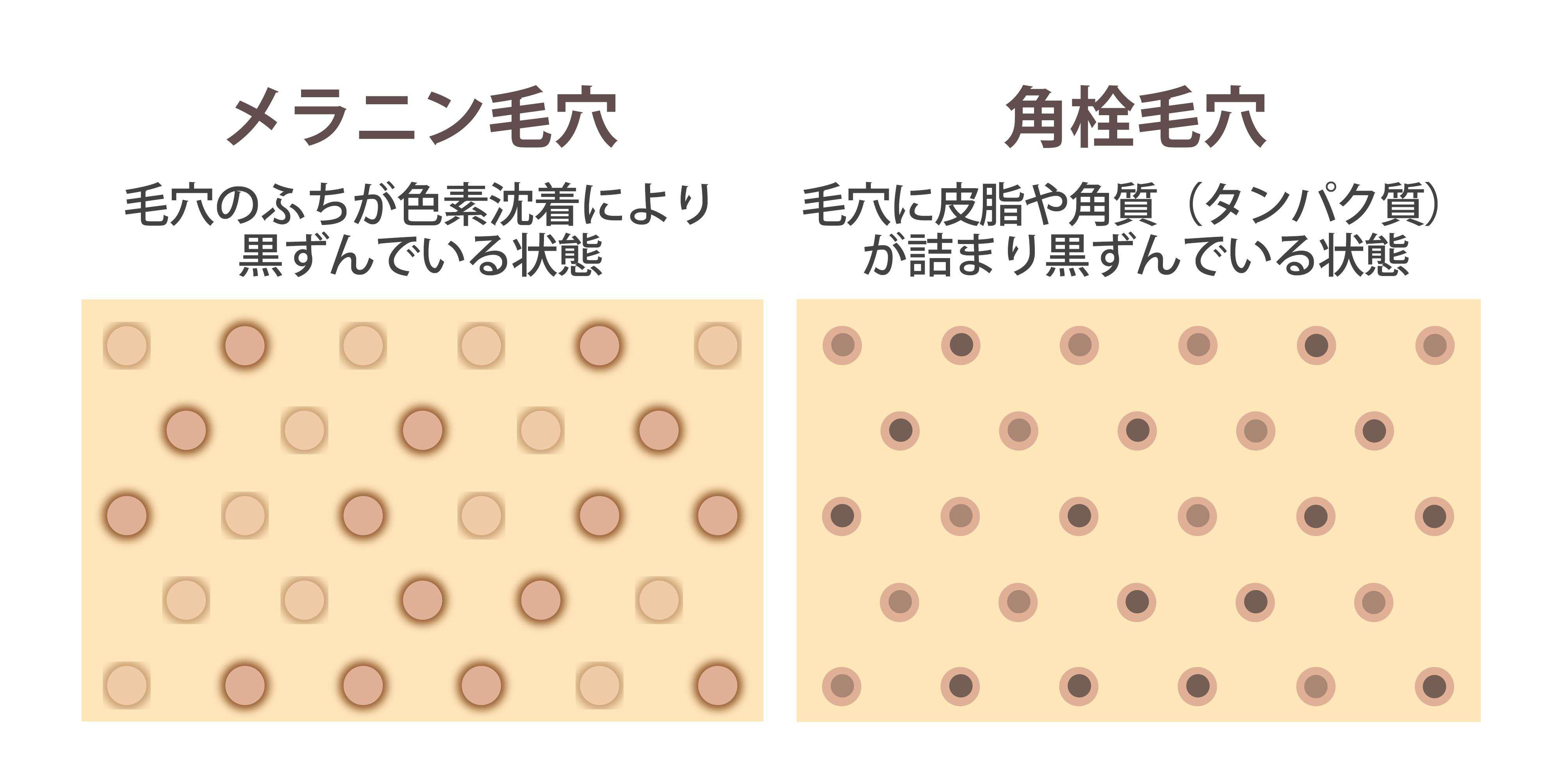 毛穴ケア15選｜あなたの鼻は角栓毛穴？たるみ毛穴？黒ずみ・毛穴開きにおすすめを紹介！