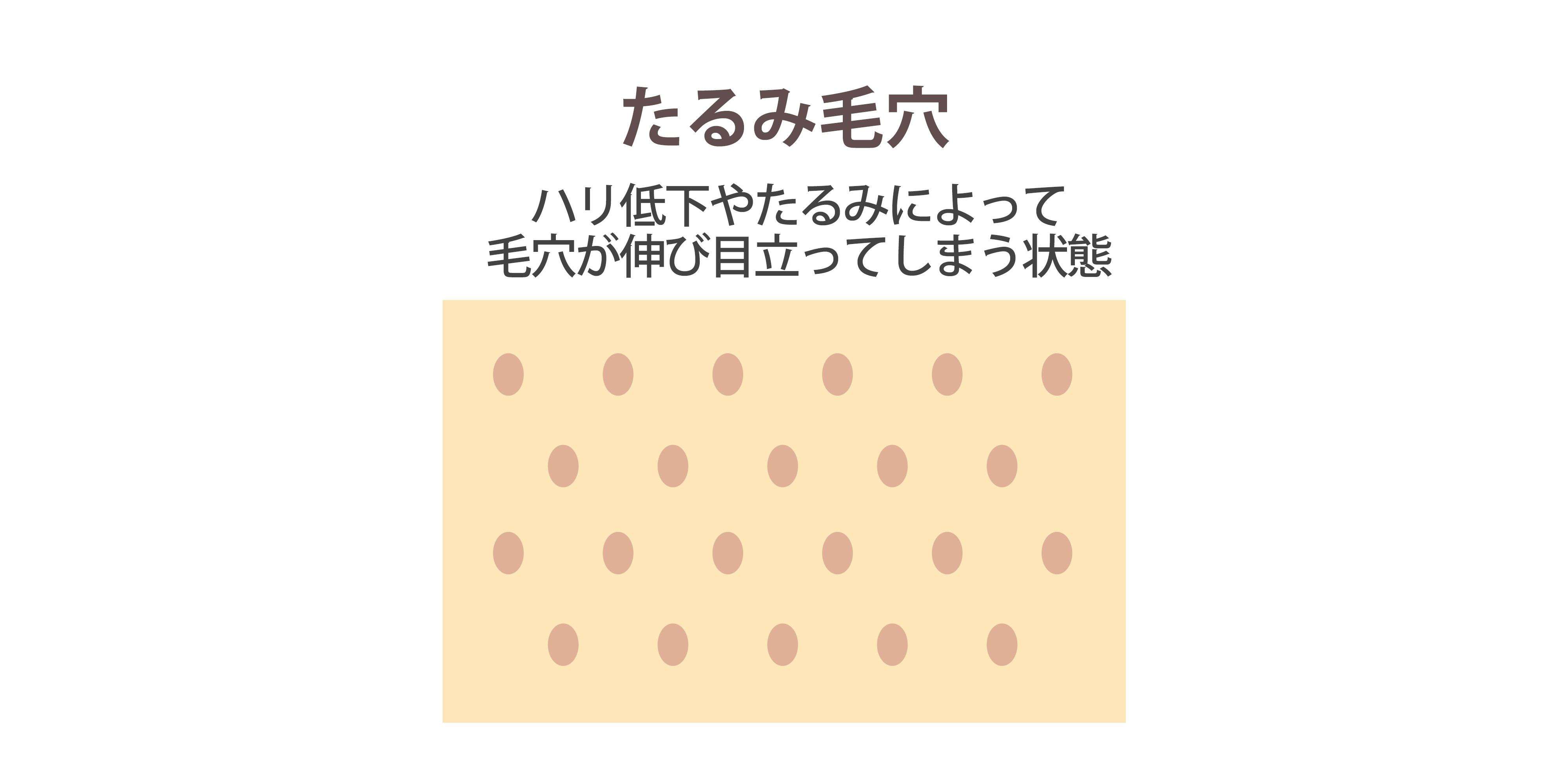 毛穴ケア15選｜あなたの鼻は角栓毛穴？たるみ毛穴？黒ずみ・毛穴開きにおすすめを紹介！